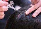 Understand the benefits of a Scalp Treatment